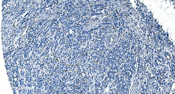 Anti-GNG11 Antibody