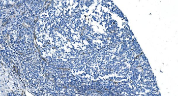 Anti-GNG11 Antibody