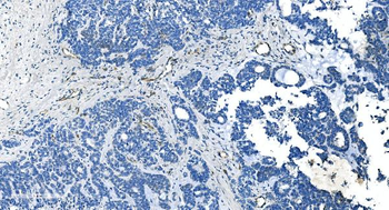 Anti-GNG11 Antibody