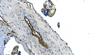 Anti-GNG11 Antibody