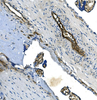 Anti-GNG11 Antibody