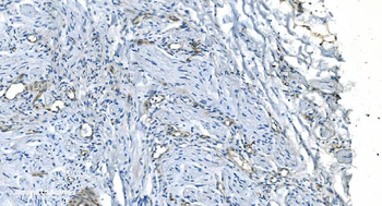 Anti-GNG11 Antibody