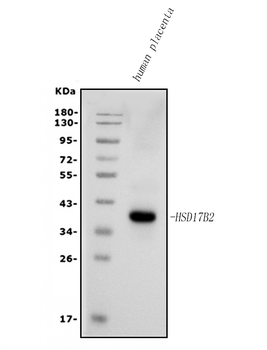 Anti-HSD17B2 Antibody