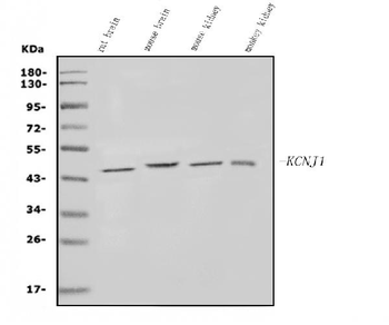 KCNJ1 Rabbit Polyclonal Antibody
