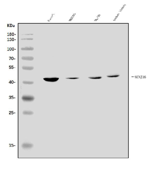 Anti-KCNJ16 Antibody