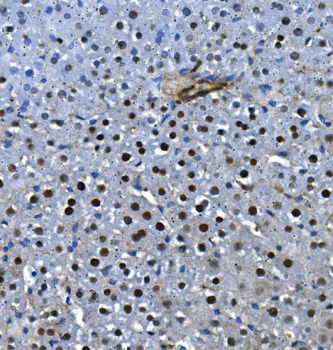 Anti-LSM5 Antibody