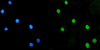 Anti-LSM5 Antibody