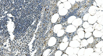 Anti-LSM5 Antibody