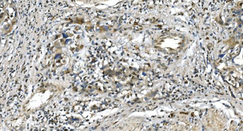Anti-LSM5 Antibody