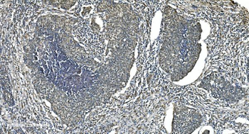 Anti-LSM5 Antibody