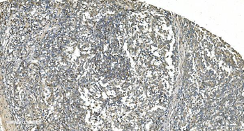 Anti-LSM5 Antibody