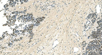 Anti-LSM5 Antibody