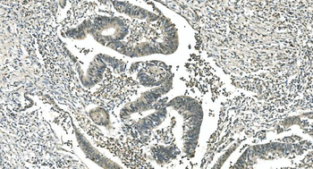 Anti-LSM5 Antibody