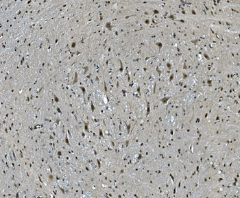 Anti-LSM7 Antibody