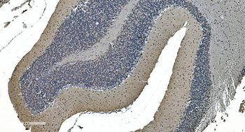 Anti-LSM7 Antibody