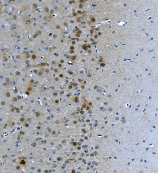 Anti-LSM7 Antibody