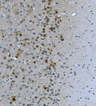 Anti-LSM7 Antibody