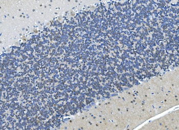 Anti-LSM7 Antibody
