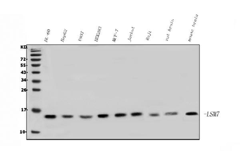 Anti-LSM7 Antibody