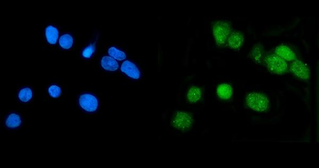 Anti-LSM7 Antibody