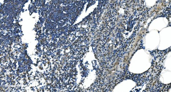 Anti-LSM7 Antibody