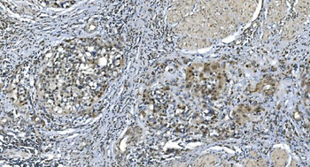 Anti-LSM7 Antibody