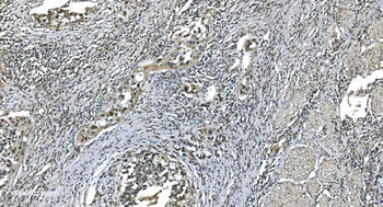 Anti-LSM7 Antibody
