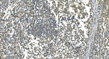 Anti-LSM7 Antibody