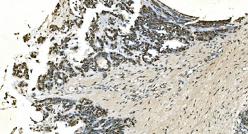 Anti-LSM7 Antibody