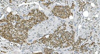 Anti-LSM7 Antibody