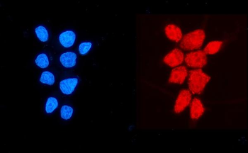 Anti-NDUFB5 Antibody
