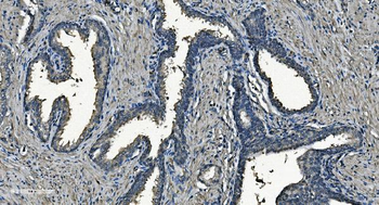 Anti-NDUFB5 Antibody