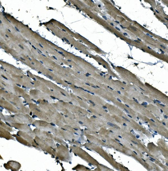Anti-NDUFB5 Antibody