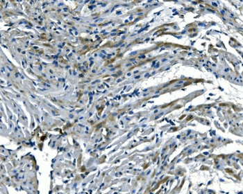 Anti-NDUFB5 Antibody