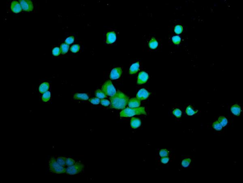 Anti-OTULIN Antibody