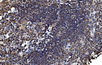Anti-OTULIN Antibody