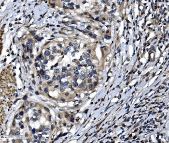 Anti-OTULIN Antibody