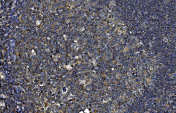 Anti-OTULIN Antibody