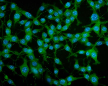 Anti-PAR4/Pawr Antibody