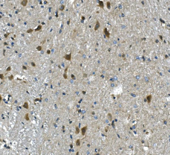 Anti-PAR4/Pawr Antibody
