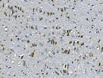 Anti-PAR4/Pawr Antibody