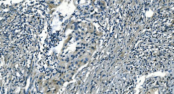 Anti-PI-16/PI16 Antibody