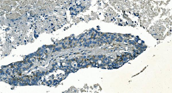 Anti-PI-16/PI16 Antibody