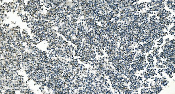 Anti-PI-16/PI16 Antibody