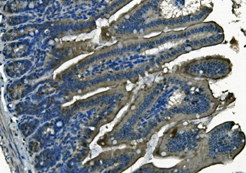 Anti-PI-16/PI16 Antibody