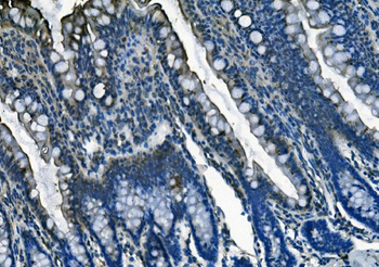 Anti-PI-16/PI16 Antibody