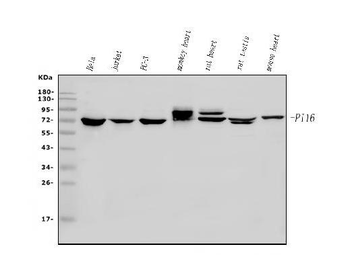 Anti-PI-16/PI16 Antibody
