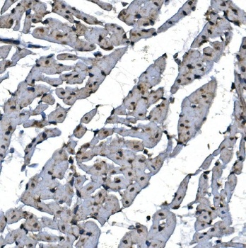 TBP-1/PSMC3 Antibody