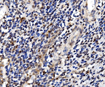Anti-TBP-1/PSMC3 Antibody