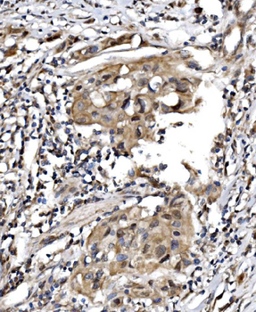 Anti-TBP-1/PSMC3 Antibody